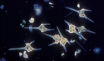 Alge Ceratium hirundinella, lichtmikroskopische Aufnahme, Vergrößerung 160-fach, Dr. R. Kümmerlin.